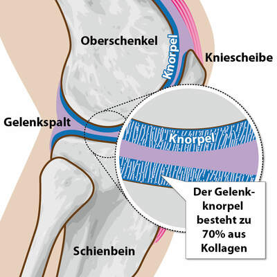 Info-Grafik: Knie gebeugt mit Knorpel